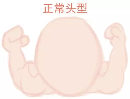 ԲͷվɱͷЩ趼֪1.webp.jpg