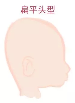 ԲͷվɱͷЩ趼֪4.webp.jpg