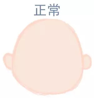 ԲͷվɱͷЩ趼֪5.webp.jpg